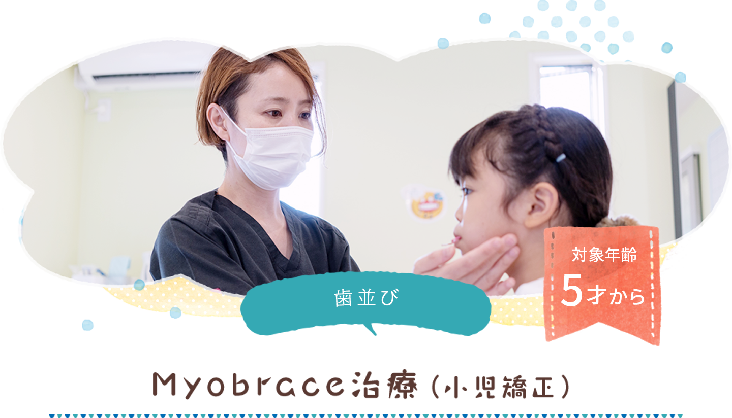 myobraceの治療